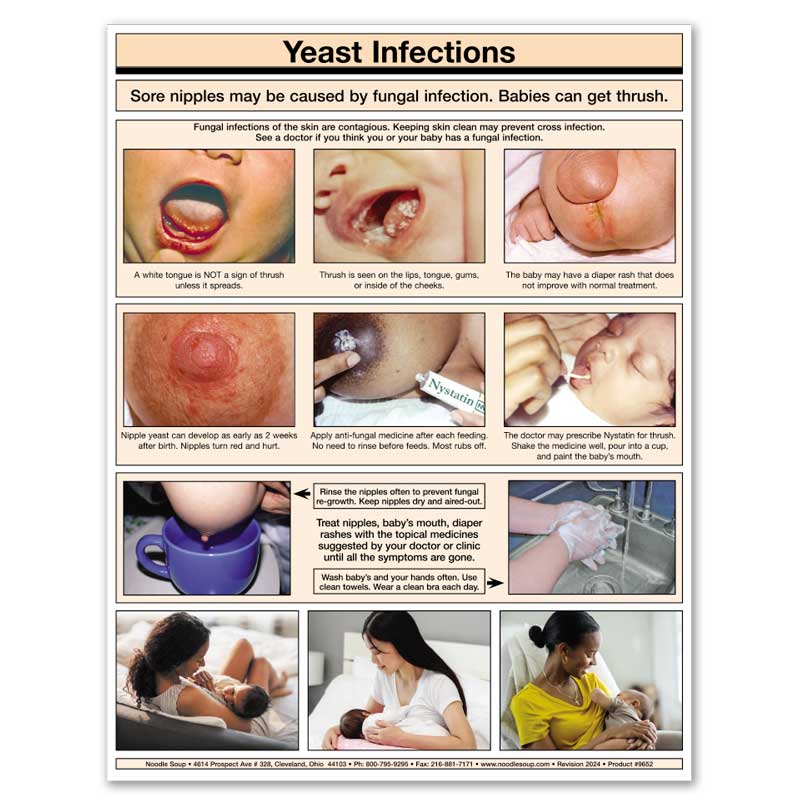 Sore Nipples & Yeast Infection tear pad