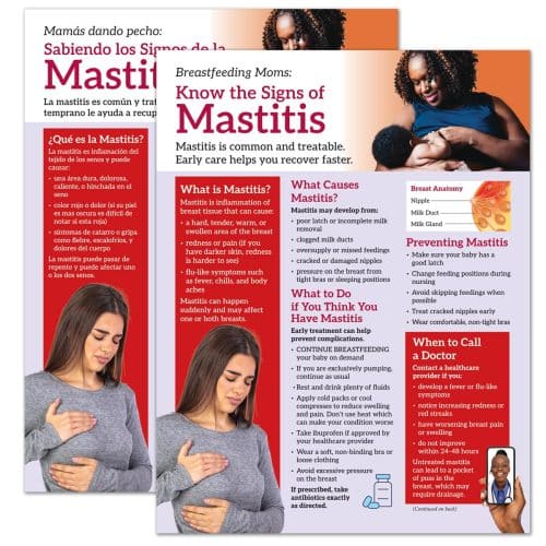 Mastitis tear pad breastfeeding education handout in English and Spanish