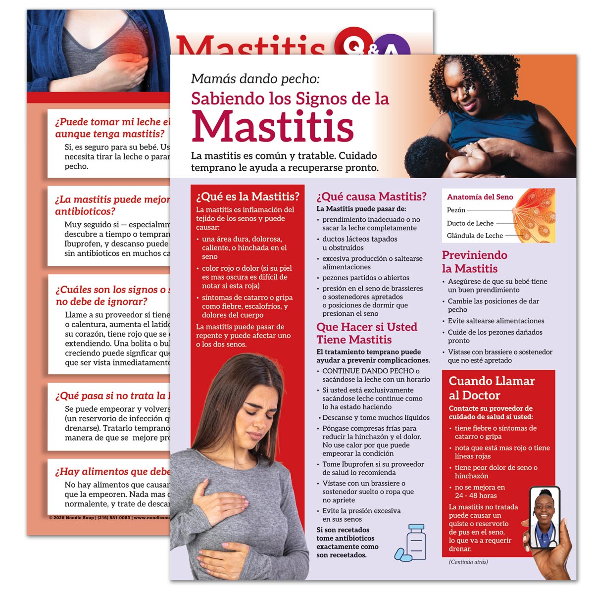Spanish mastitis tear pad breastfeeding education handout front and back